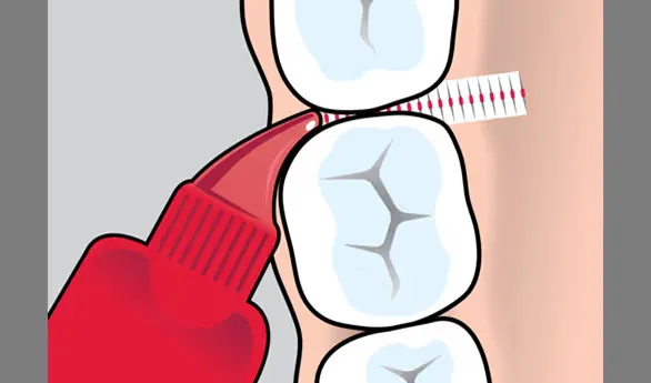 Stim Flosser Pack Of 10 Box (1 Box Contains 40Pcs)