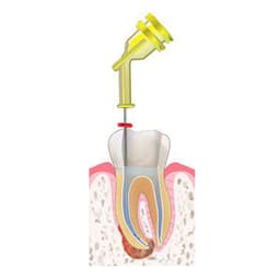 Ultrad