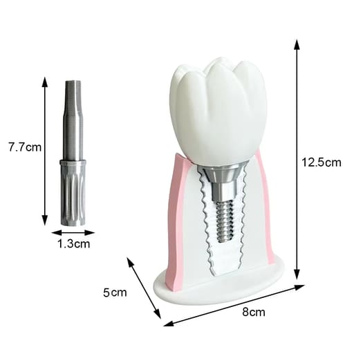 iDENTical Implant Demonstration & Explanation Model