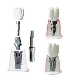 iDENTical Implant Demonstration & Explanation Model - 6