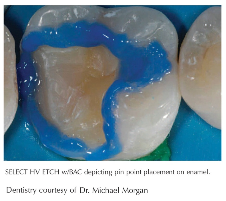 Shofu BeautifIl II Enamel & Gingiva