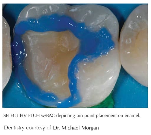 Shofu BeautifIl II Enamel & Gingiva