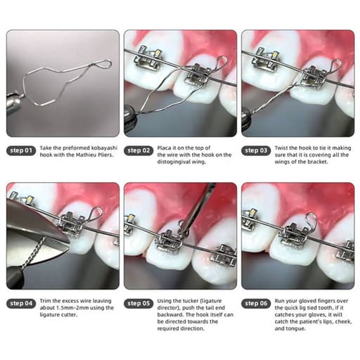 UU Ortho Kobayashi Ligature Wire Short 5.5cm (Pack of 100)