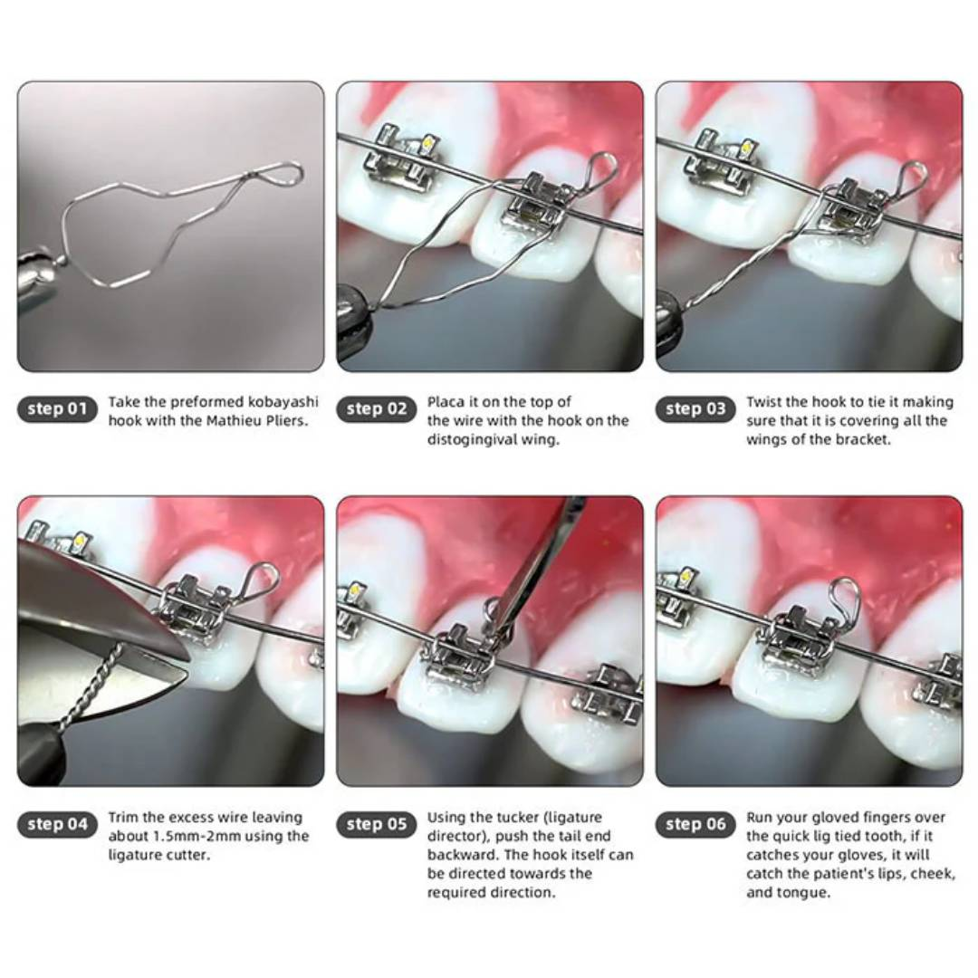 UU Ortho Kobayashi Ligature Wire Twisted Short 2.5cm (Pack of 100)