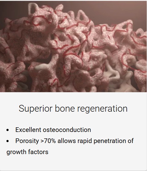 Medpark S1 Xenograft Bone Graft Powder 0.25g | Dentalkart
