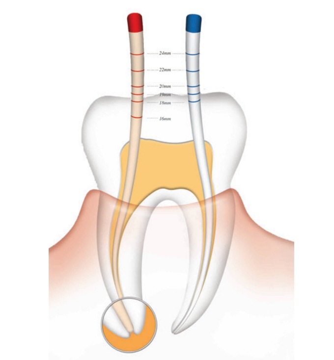 Diadent Gutta Percha Points 6%