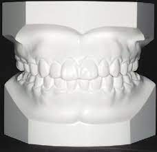 Cotisen Upper Tray Base Former