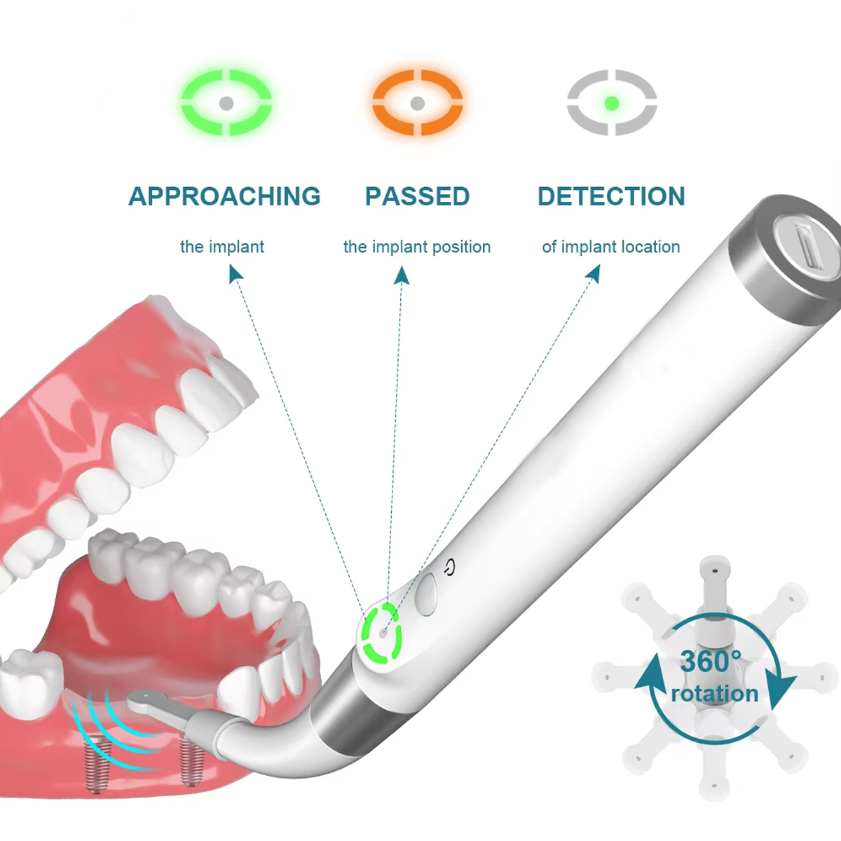 Waldent Dental Implant Locator iD1