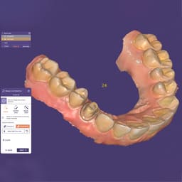 Shining 3D Aoralscan 3 Intra Oral Scanner - Standard - 10