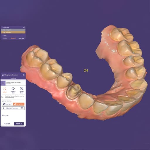 Shining 3D Aoralscan 3 Intra Oral Scanner - Standard