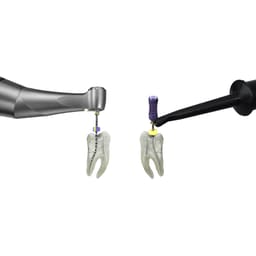 Dentsply X-Smart Pro Plus Endomotor with Integrated Apex Locator - 14
