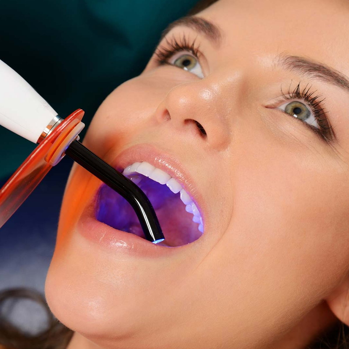 Endoking ECO Plus Composite Light Cure Unit