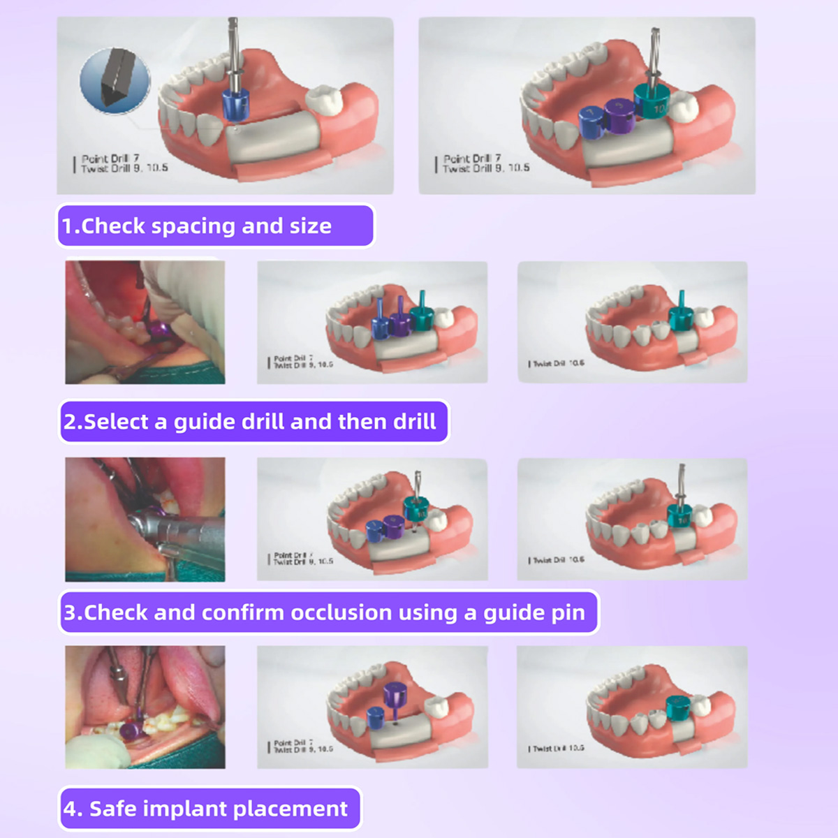 Dental Implant Positioning Kit
