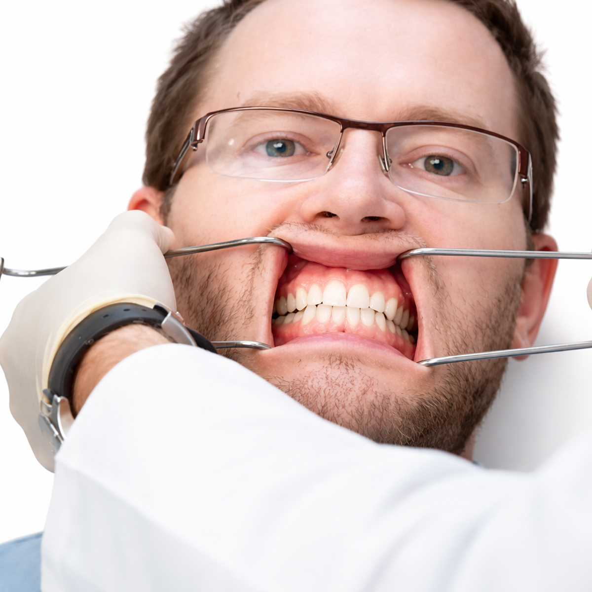 Waldent Sternberg Cheek Retractors