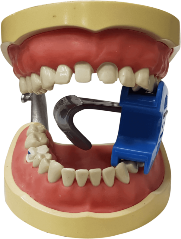 MiK Isolator Kit - 8 Tongue Deflectors