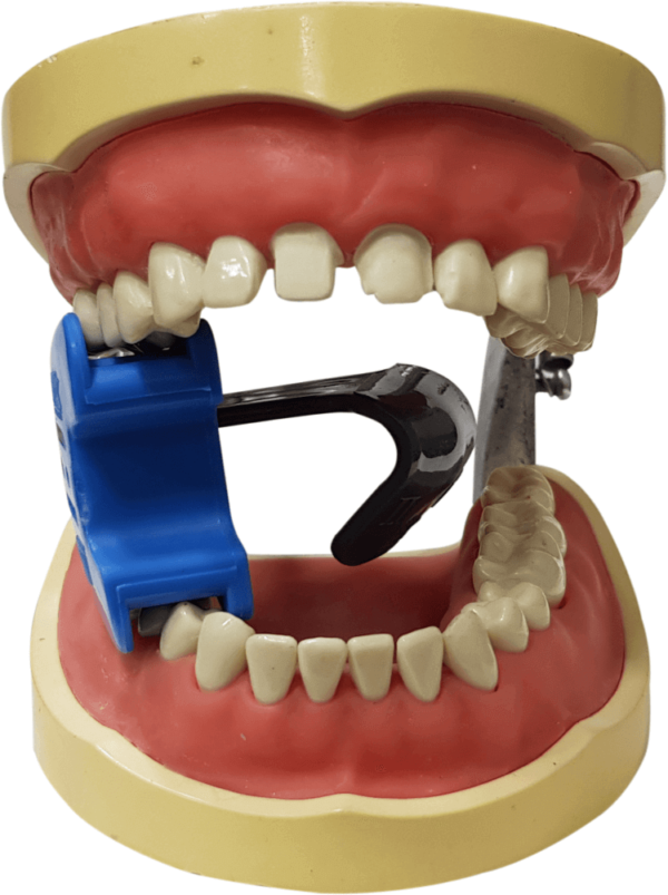 MiK Isolator Kit - 8 Tongue Deflectors