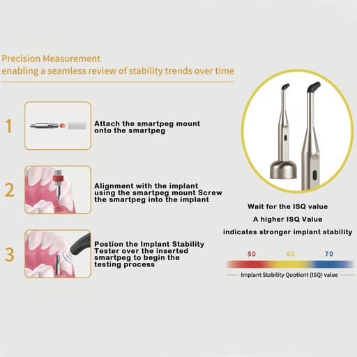 DentalPlant Implant Stability Tester - Golden