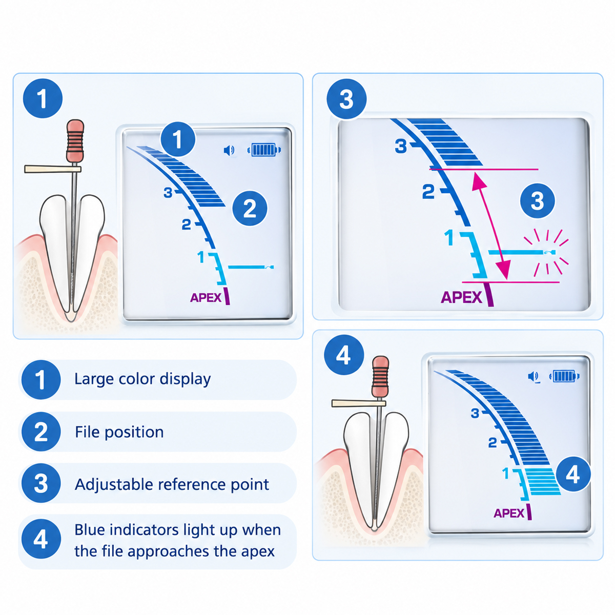 Buy J Morita Root ZX II Apex Locator (Dentaport ZX) online at best