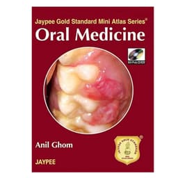 Jaypee Medical Oral Medicine (ISBN - 483468)
