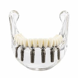 Julldent Lower Jaw Implant Model (JULL-DENT 208) - 3