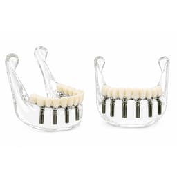 Julldent Lower Jaw Implant Model (JULL-DENT 208) - 1