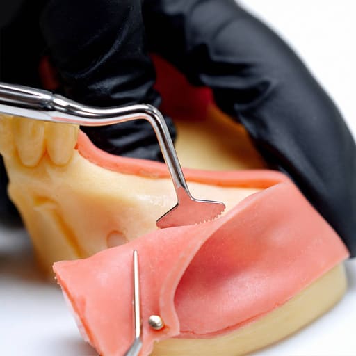 Julldent Soft Tissue Expander for Periosteum Release
