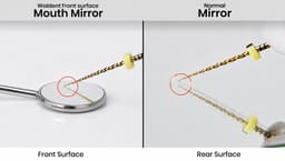 Waldent Wal-Vision Rhodium Coated Mouth Mirror Tops (Pack of 1) - 8