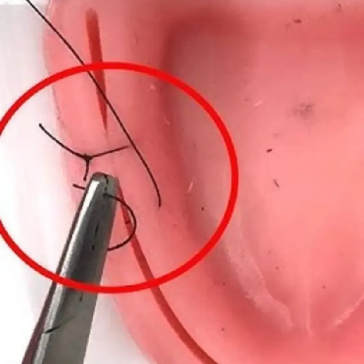 Ethicon #3-0 Black Braided Silk Suture Reels 25Mtr (R 822) - Pack of 6