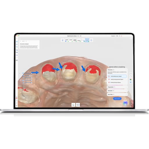 Medit i900 Classic Intraoral Scanner