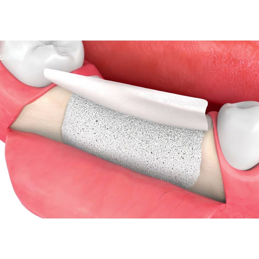 MedPark Colla Resorbable Collagen Membrane | Soft Type | 10mmX20mm