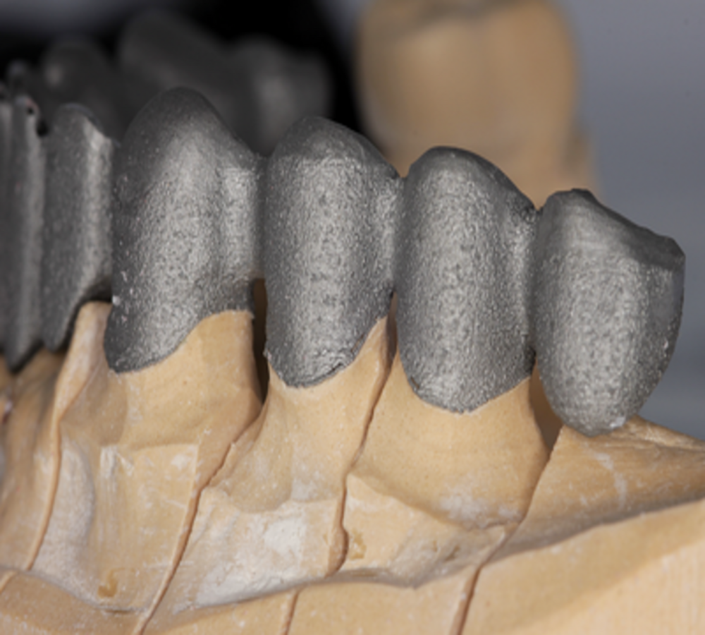 Labodent Nickel Chromium Alloy Powder (10-30μm) - 5Kg