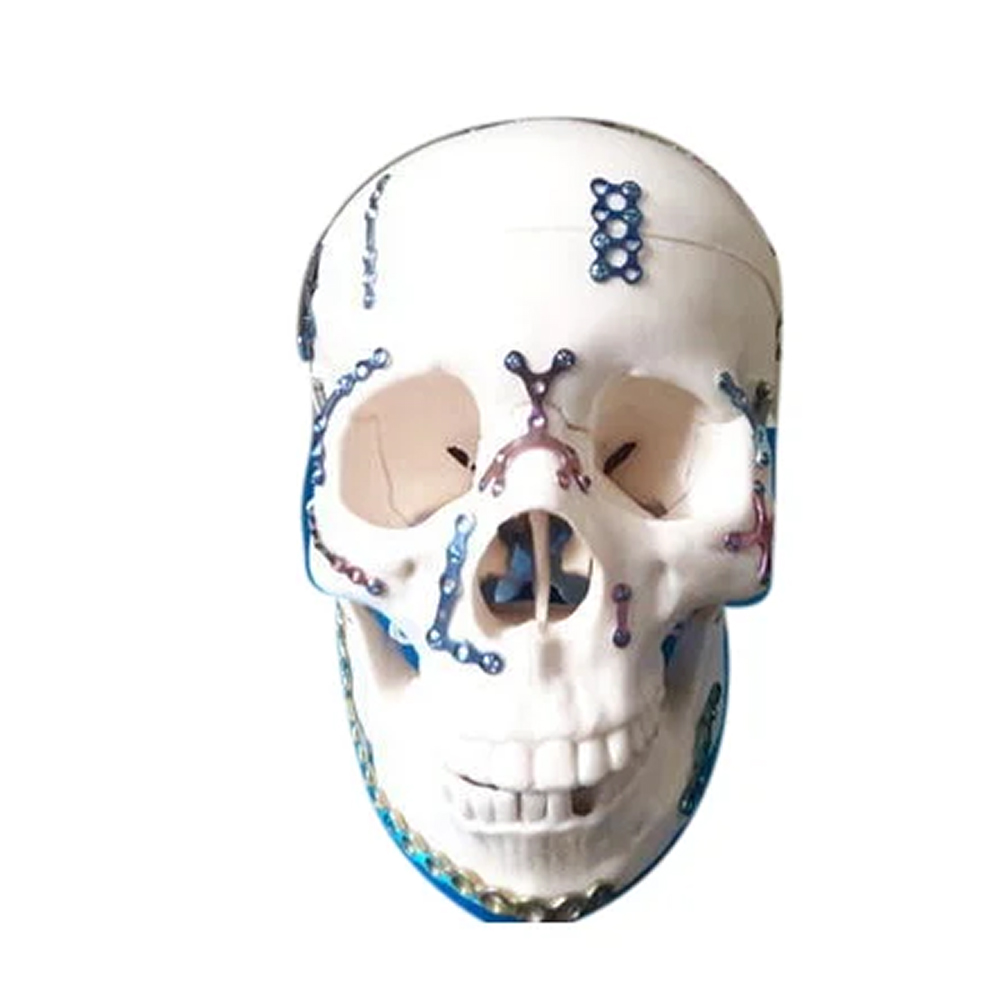 SK Surgicals SS Mini Bone Plates Y Shape With Gap - 2mm (200.580S)