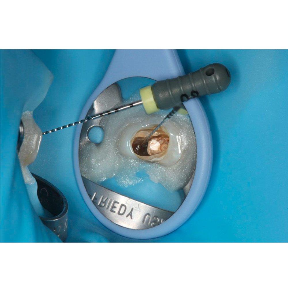 Hahnenkratt Relax FS Rhodium Mouth Mirrors #5 (Pack Of 1)