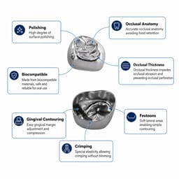 U Ortho Stainless Steel Primary Molar Crown - Assorted Kit (Set of 48) - 5
