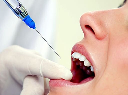 Septodont Aspirating syringe ( Imported )