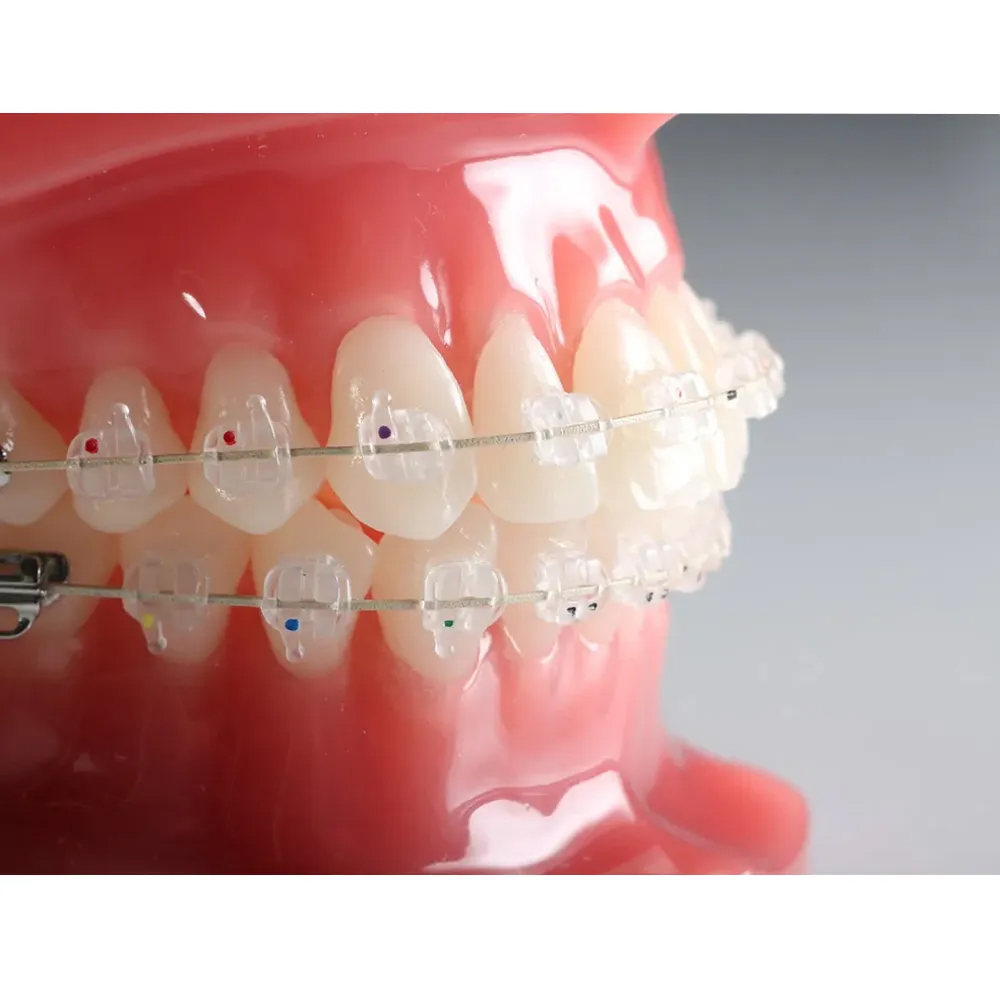 Phyx Nova Pro Ceramic Brackets