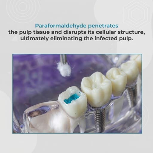 Prime Dental DeVitex Pulp Devitalising Paste