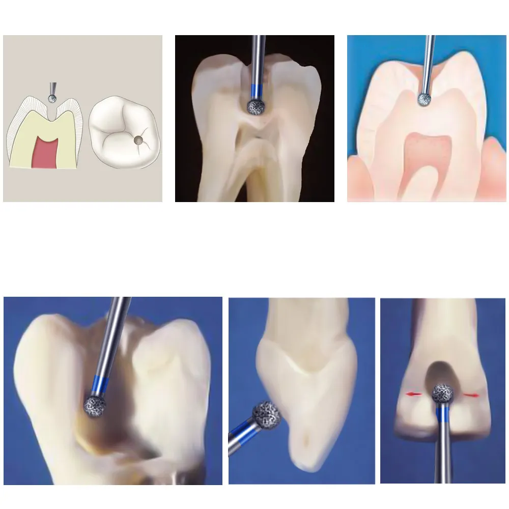 Mani Diamond Bur - Br-46 CA (For Contra-angle)