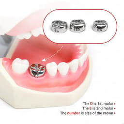 SuperEndo Stainless Steel Crowns Primary Molar Kit (Set Of 48) - 6