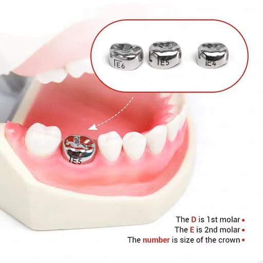 SuperEndo Stainless Steel Crowns Primary Molar Kit (Set Of 48)