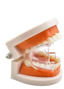 Dental Posterior Mouth Prop | Transparent - 4