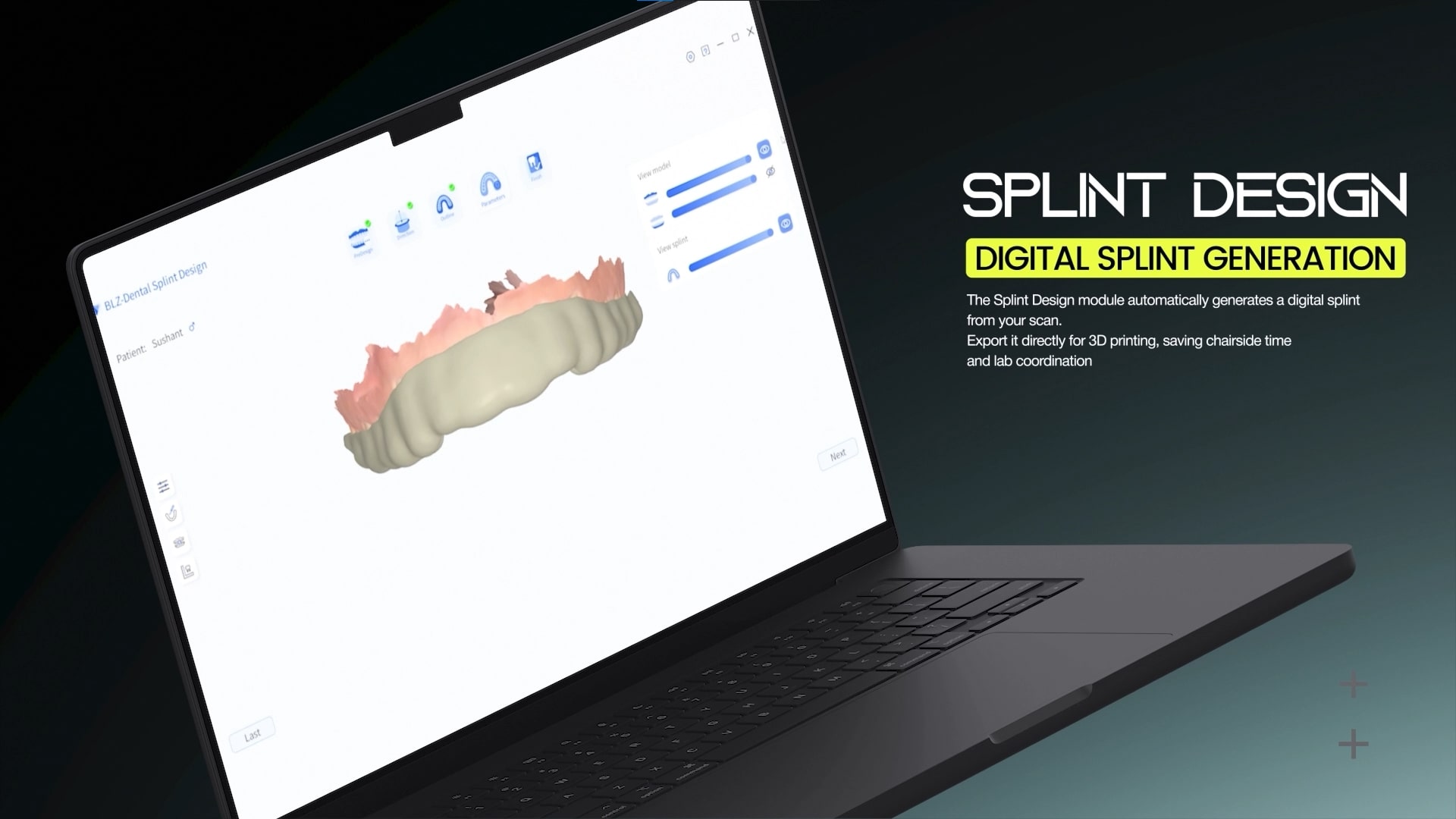 Waldent BLZ IntraVue 900 Ai Intraoral Scanner | Call +91-9311803455 For Easy Finance Options