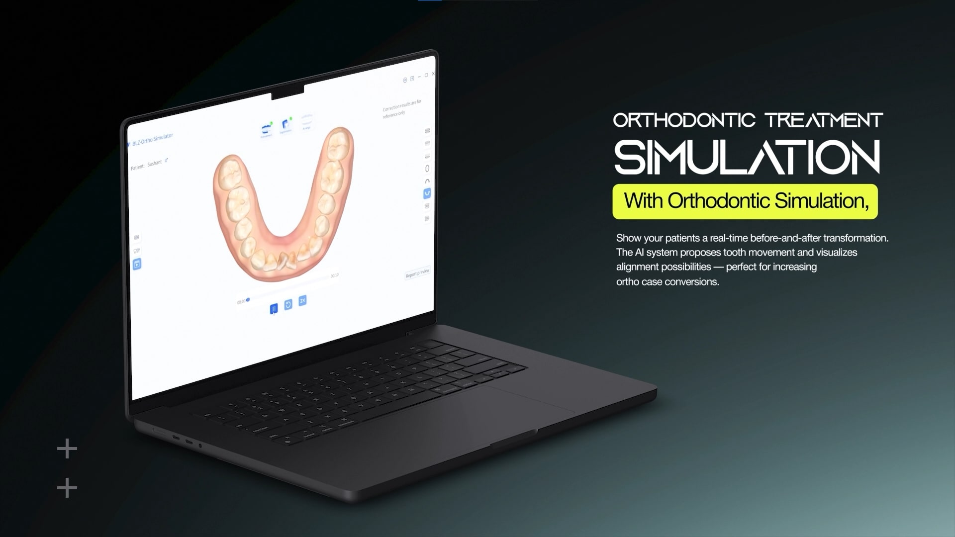 Waldent BLZ IntraVue 900 Ai Intraoral Scanner | Call +91-9311803455 For Easy Finance Options