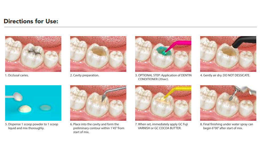 GC Gold Label Hybrid