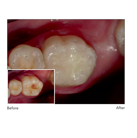 GC Gold Label Hybrid