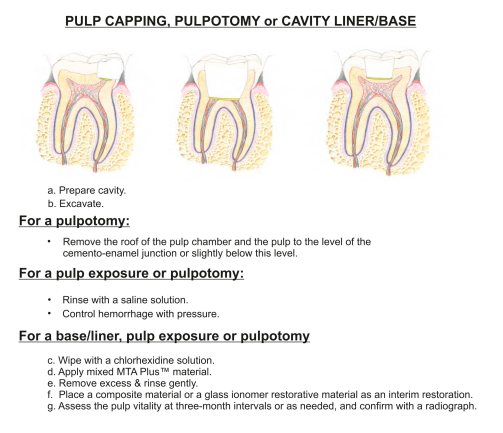 Prevest Mta Plus trial pack- 1gm