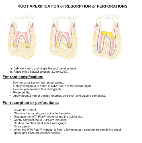 Prevest Mta Plus trial pack- 1gm