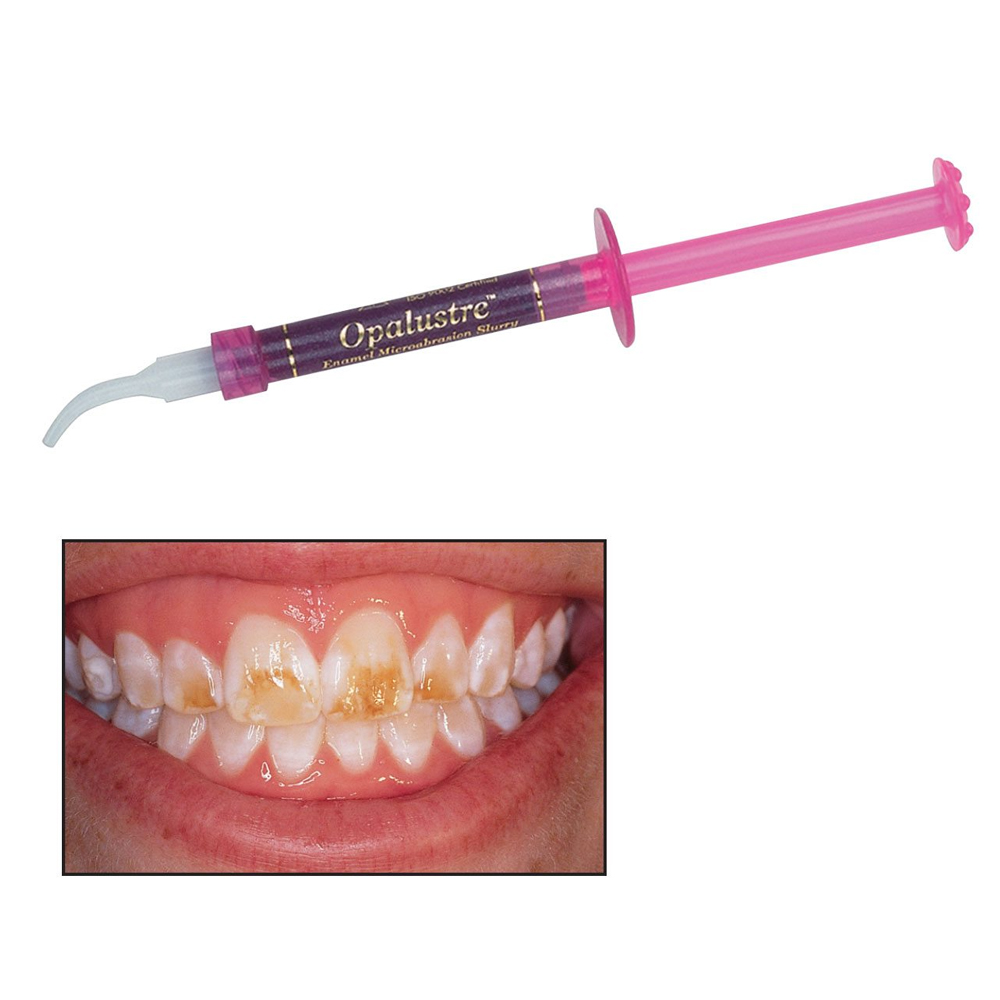 Ultradent Opalustre Syringe (Pack Of 1)