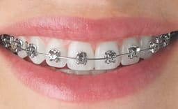 UU Ortho Super Elastic NiTi Archwires -Rectangular Pk/10 - 8