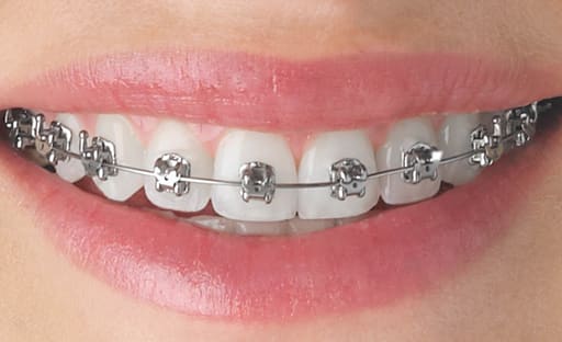 UU Ortho Super Elastic NiTi Archwires -Rectangular Pk/10
